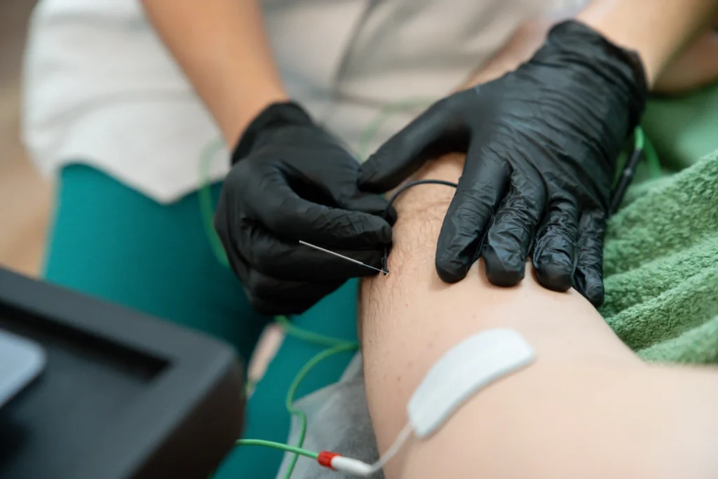 GEMMA GOMEZ_PUNCIÓN SECA_FISIOTERAPIA AVANZADA_SALAMANCA_NMP_EPI_EJERCICIO TERAPÉUTICO
